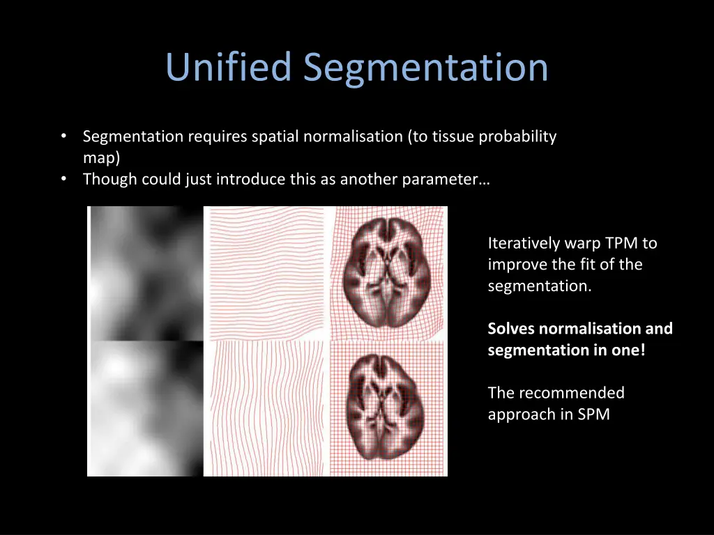 unified segmentation