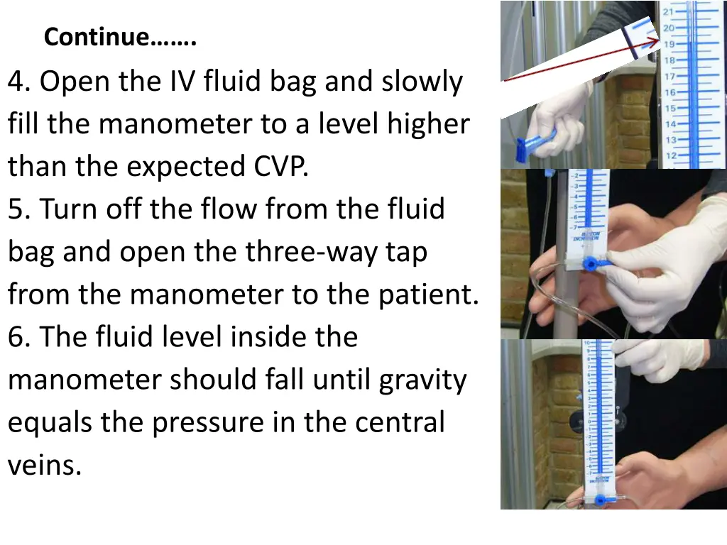 continue 4 open the iv fluid bag and slowly fill
