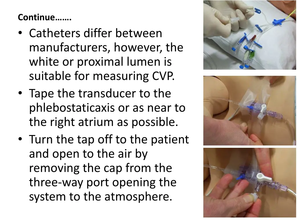 continue catheters differ between manufacturers