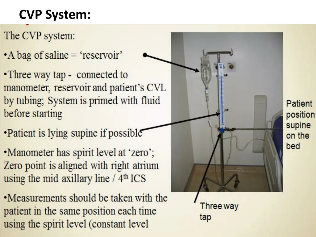 cvp system