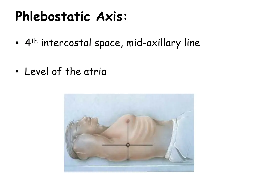 phlebostatic axis