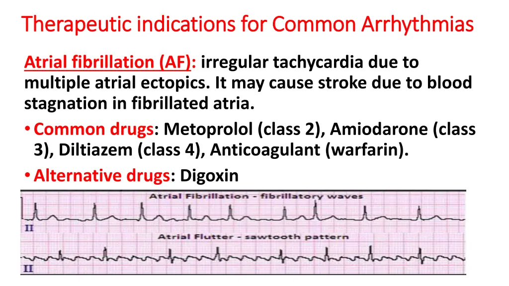 therapeutic indications for common arrhythmias
