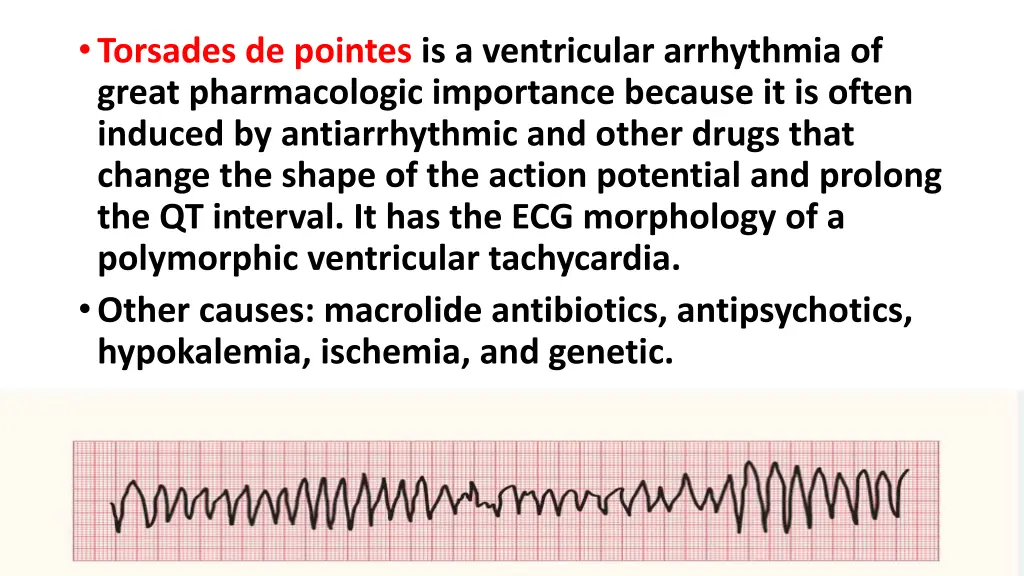 torsades de pointes is a ventricular arrhythmia