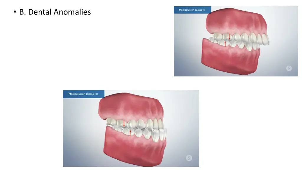b dental anomalies