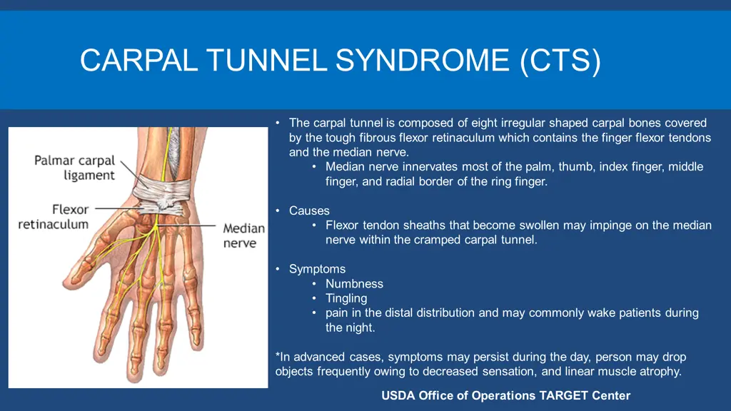 carpal tunnel syndrome cts