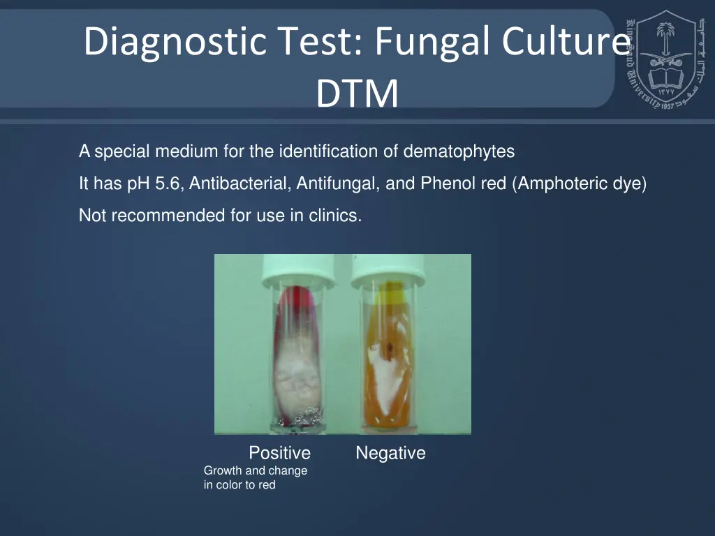 diagnostic test fungal culture dtm