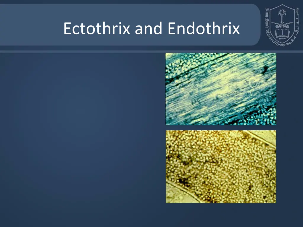 ectothrix and endothrix