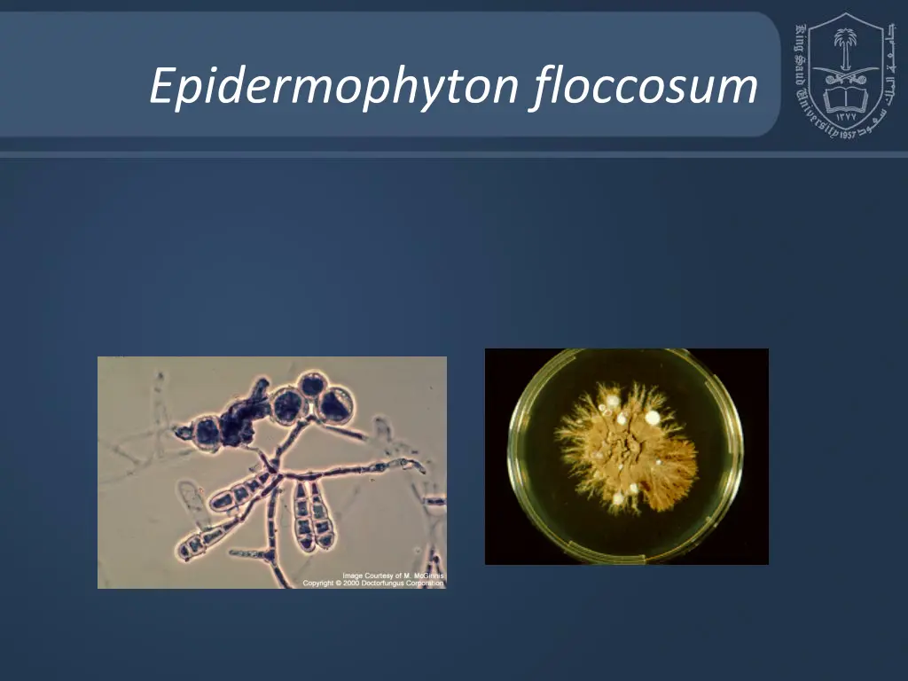 epidermophyton floccosum