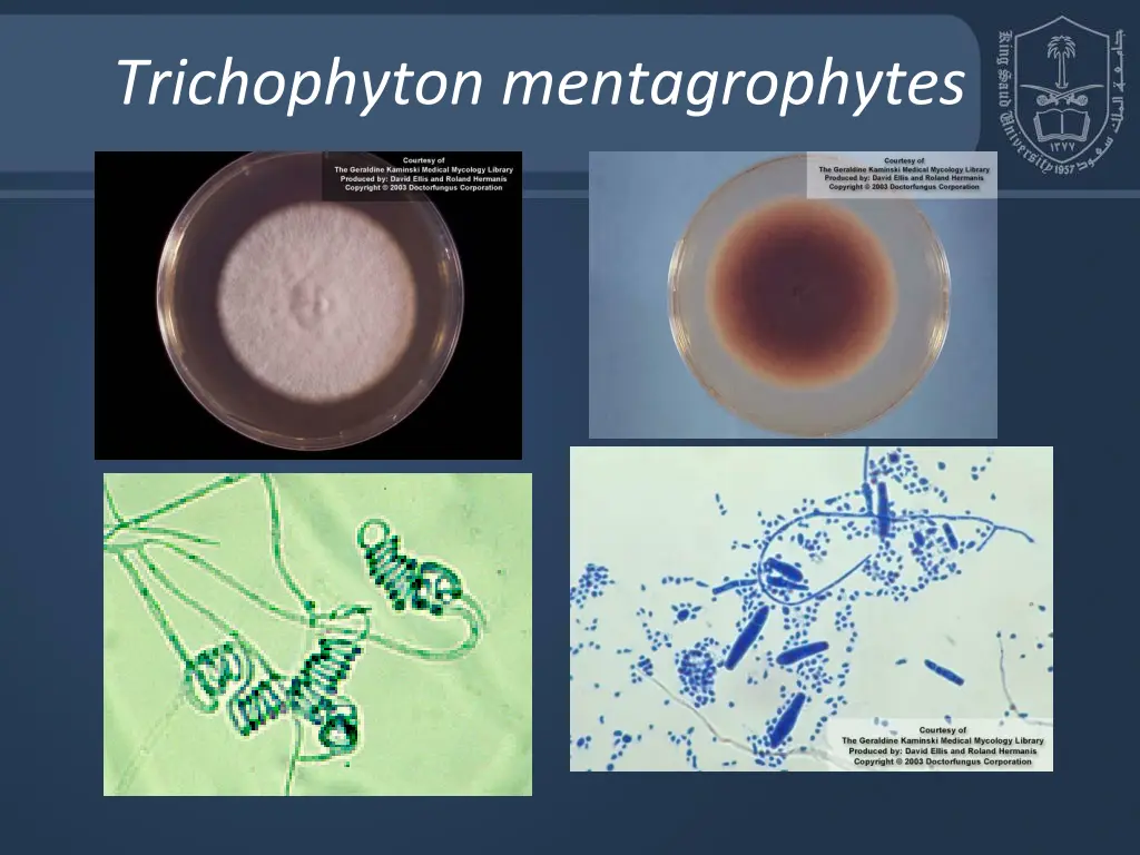 trichophyton mentagrophytes
