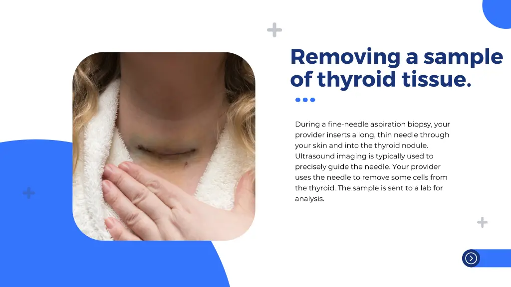 removing a sample of thyroid tissue