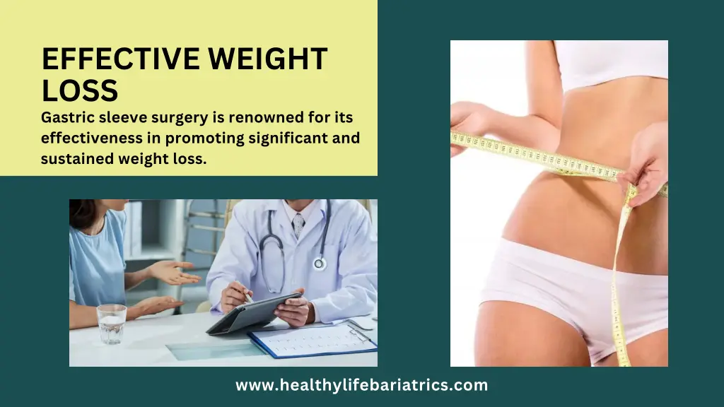 effective weight loss gastric sleeve surgery