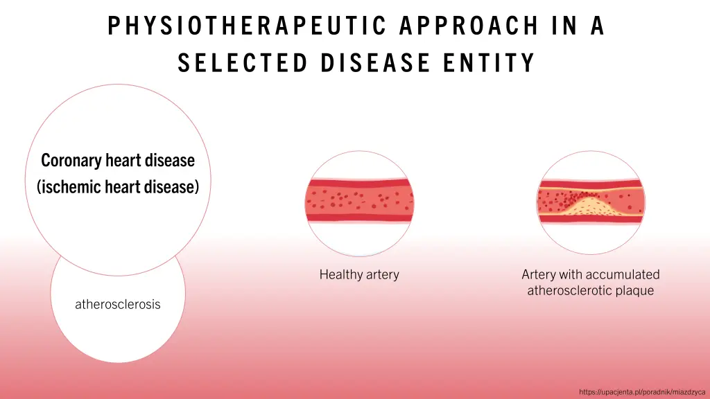 physiotherapeutic approach in a selected disease