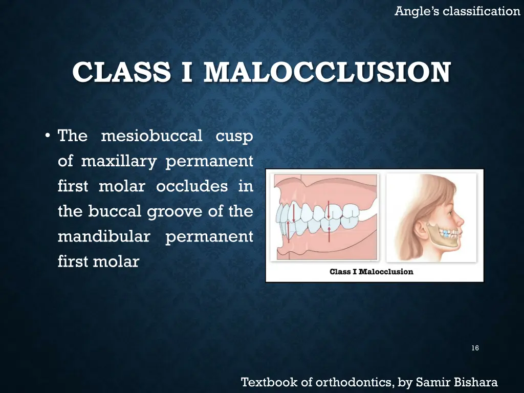 angle s classification 2