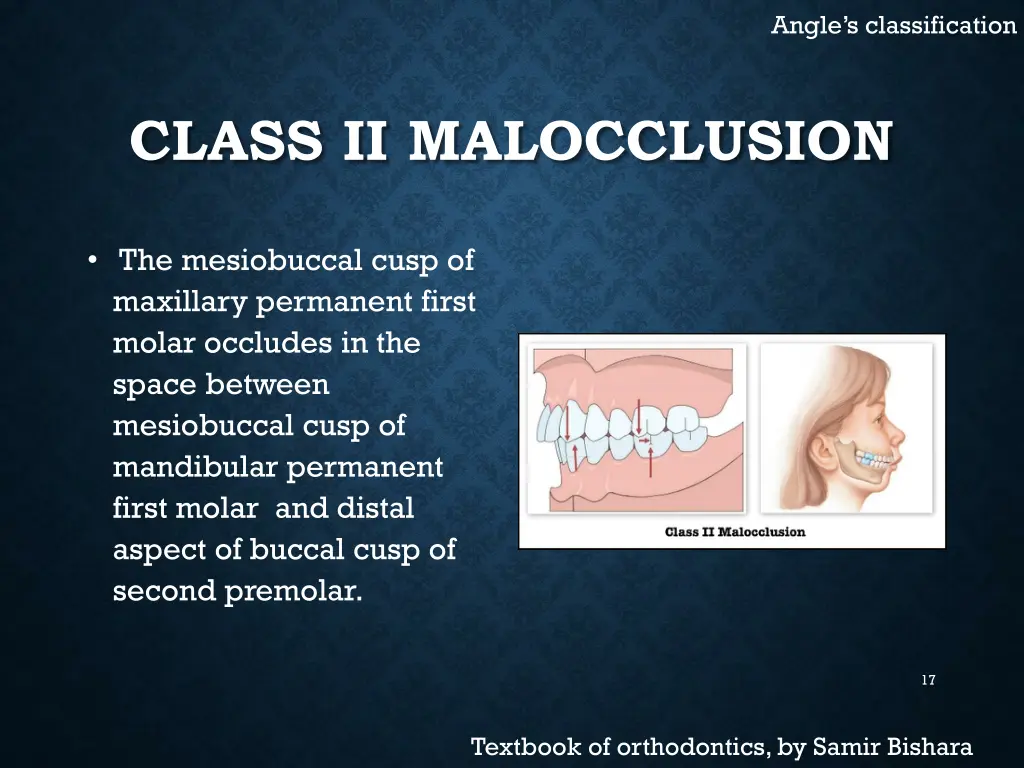 angle s classification 3