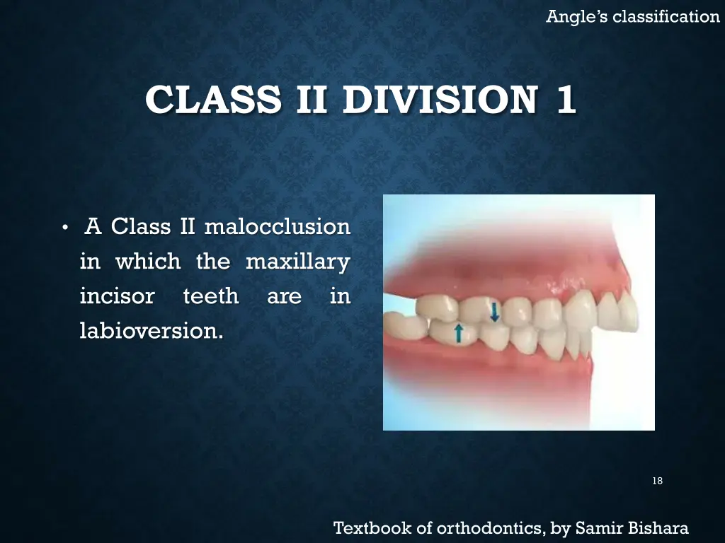 angle s classification 4