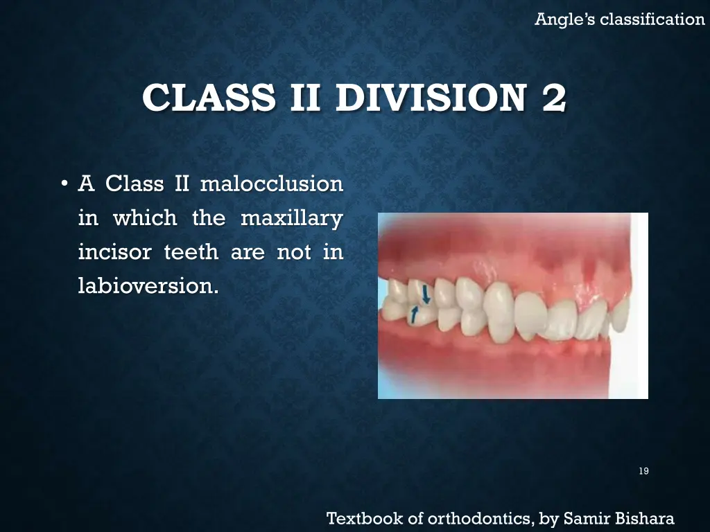 angle s classification 5