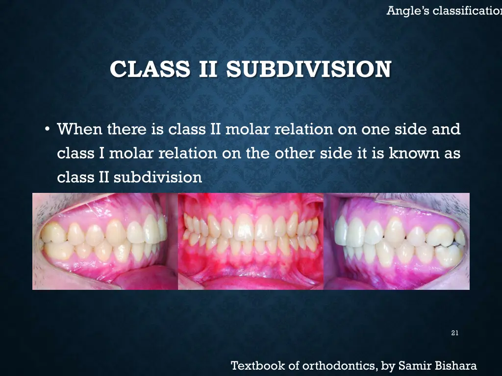 angle s classification 6