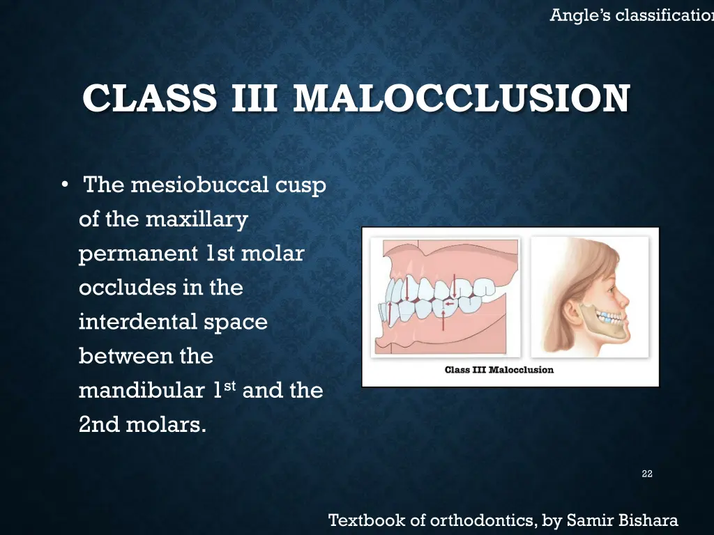 angle s classification 7