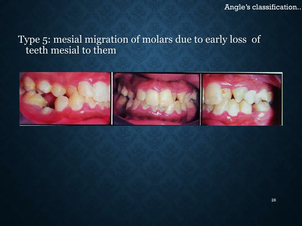 angle s classification 8