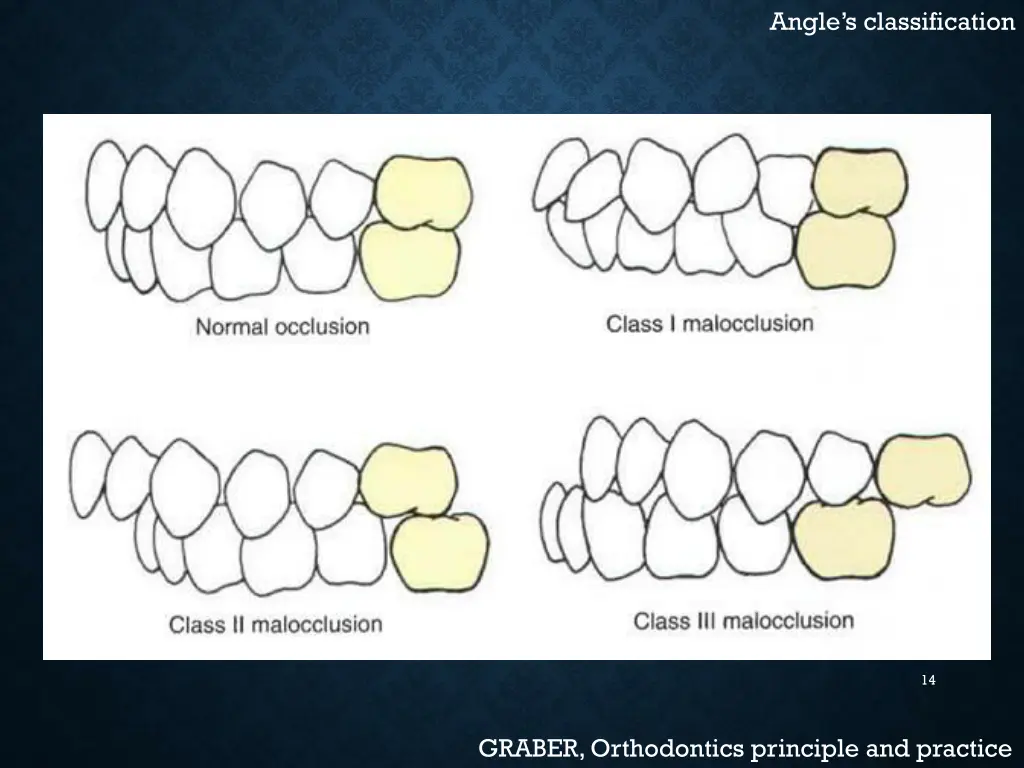 angle s classification