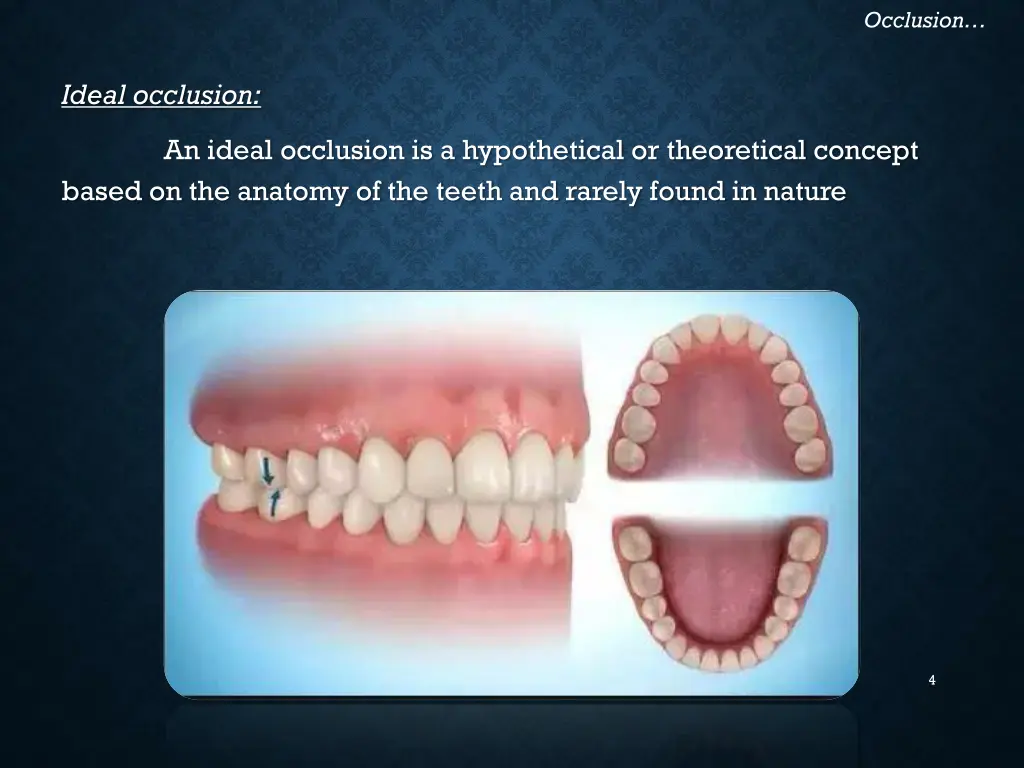 occlusion 1