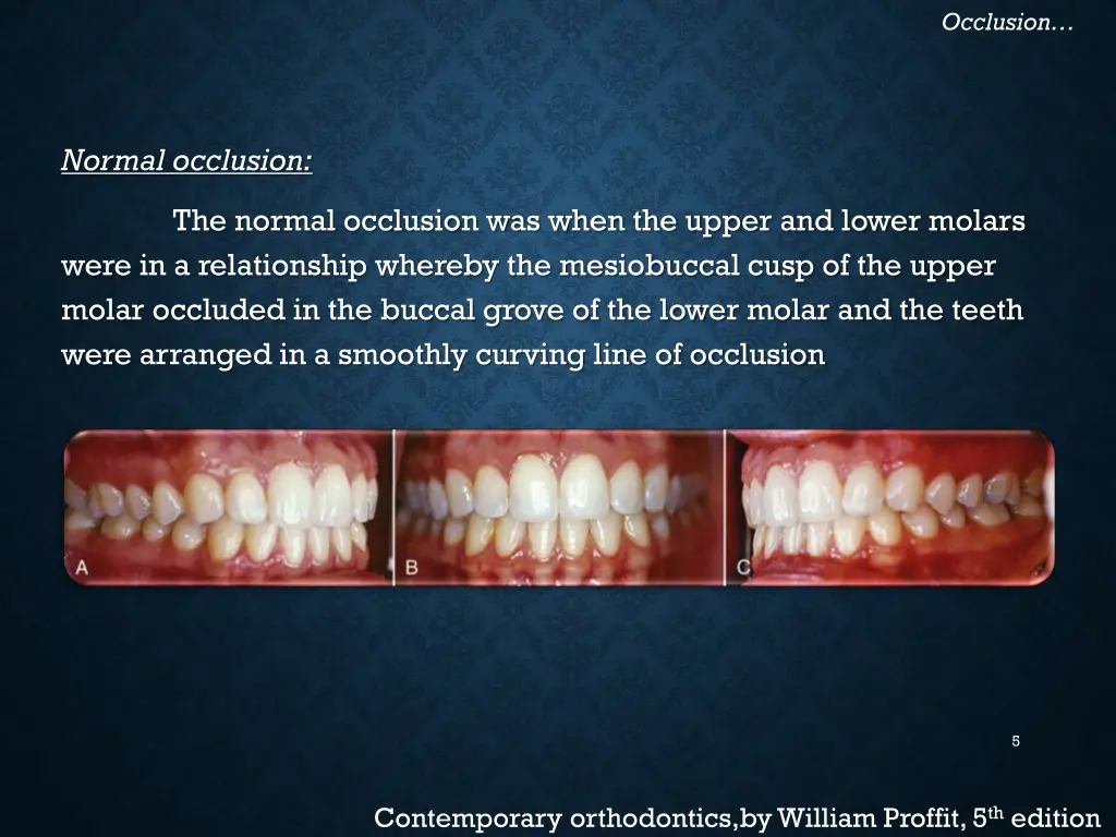 occlusion 2