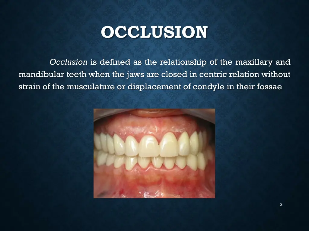 occlusion