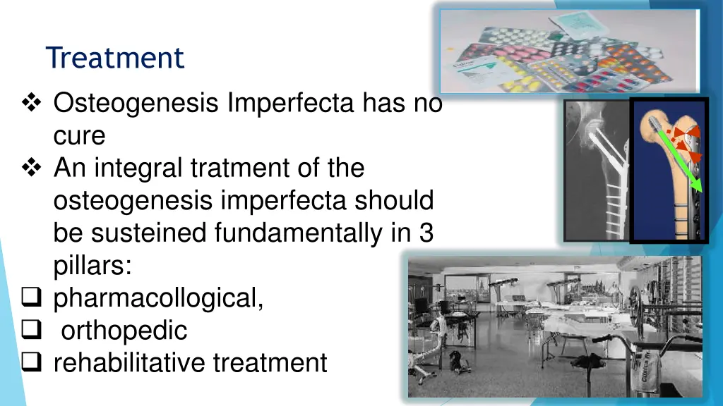 treatment osteogenesis imperfecta has no cure
