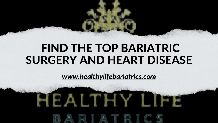 find the top bariatric surgery and heart disease