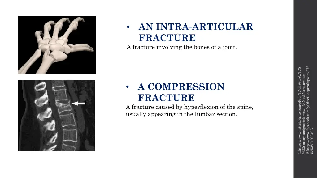 an intra articular fracture a fracture involving