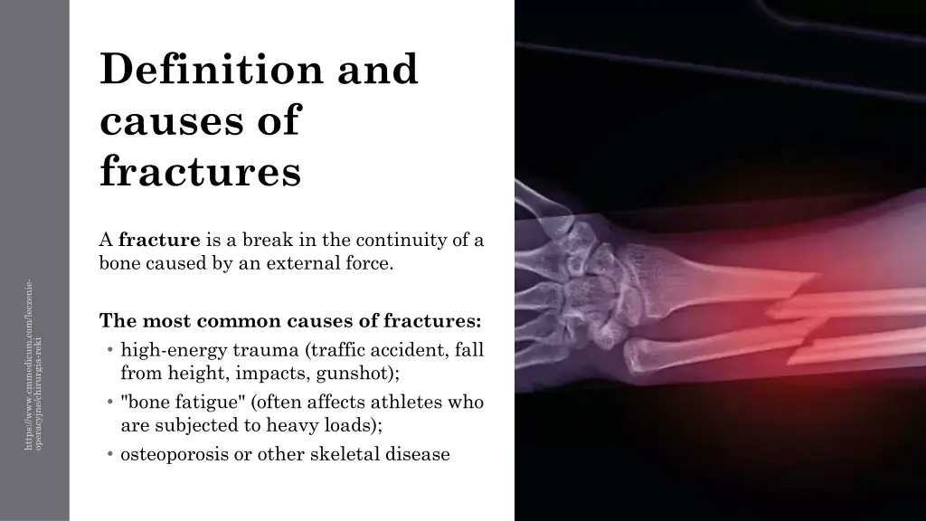 definition and causes of fractures