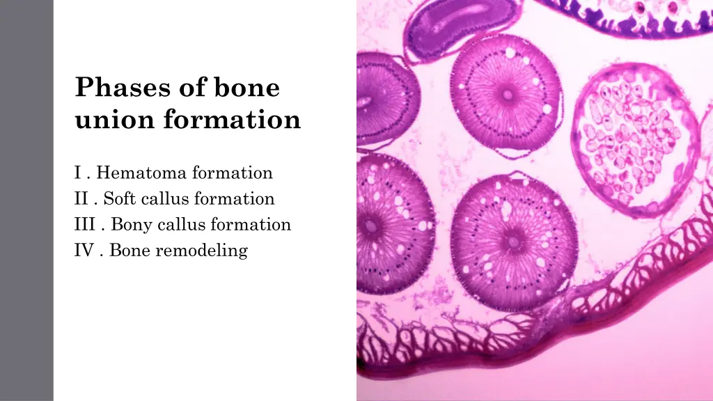 phases of bone union formation