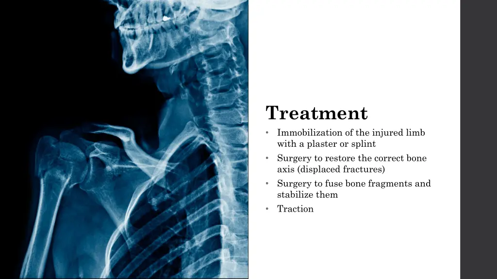 treatment immobilization of the injured limb with