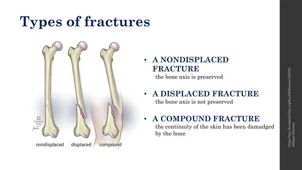 types of fractures