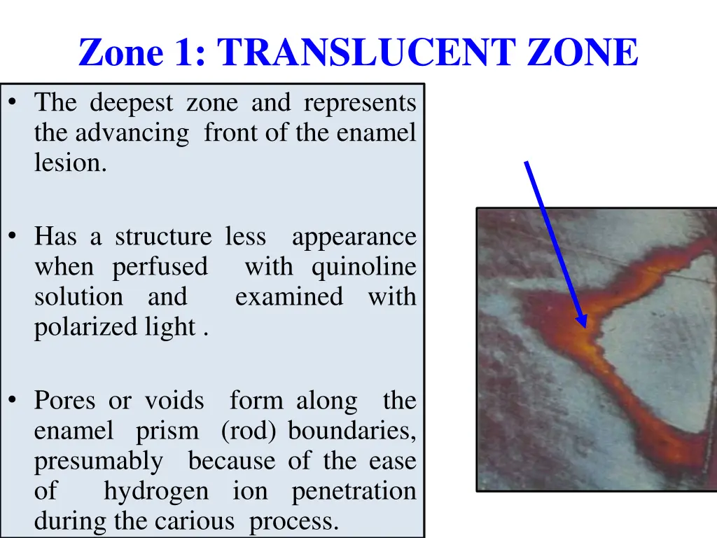 zone 1 translucent zone the deepest zone