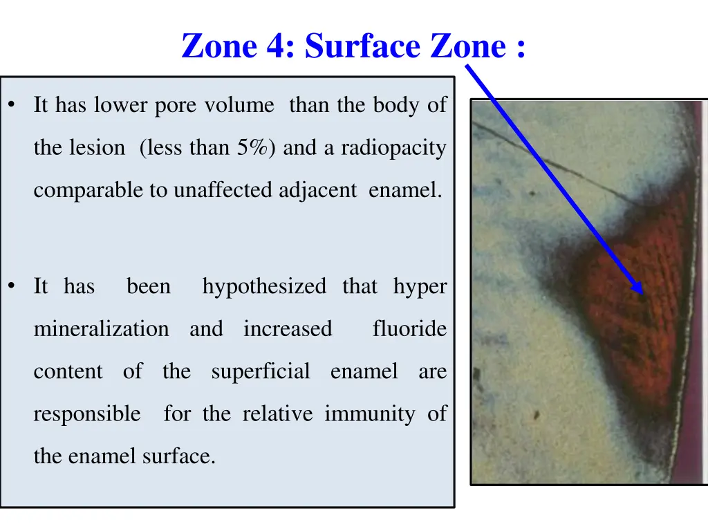 zone 4 surface zone