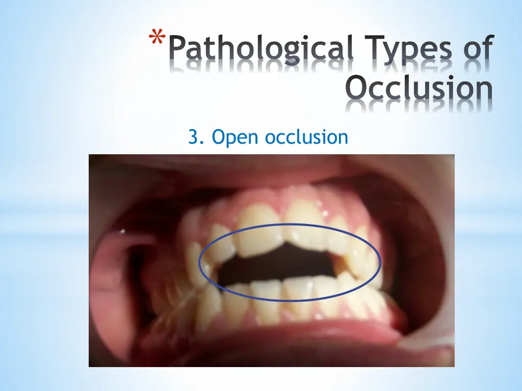 pathological types of 2