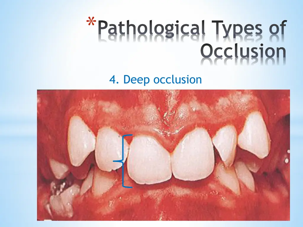 pathological types of 3