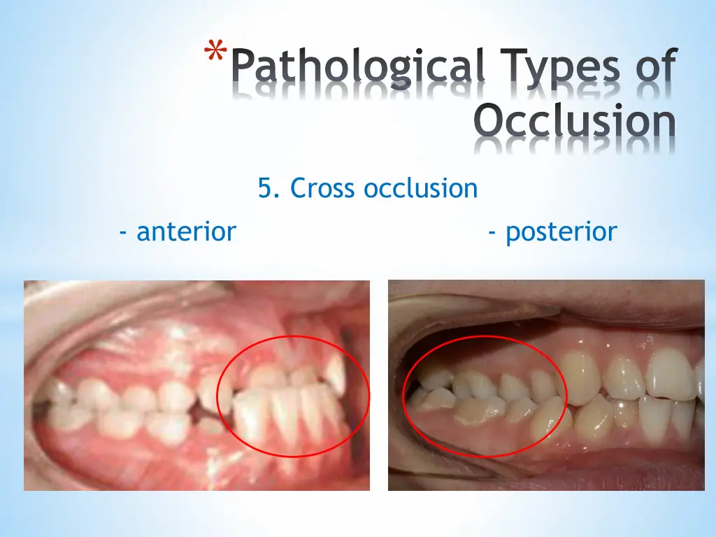 pathological types of 4