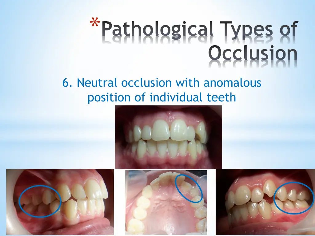 pathological types of 5