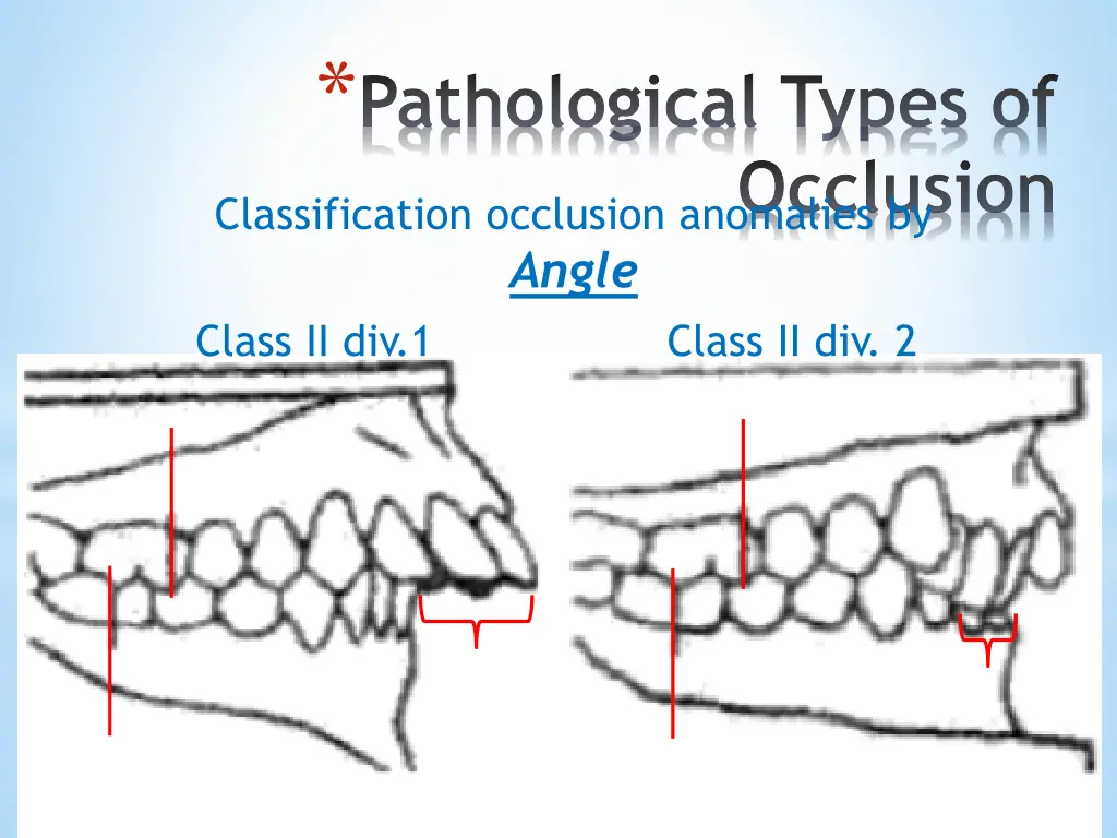 pathological types of 6