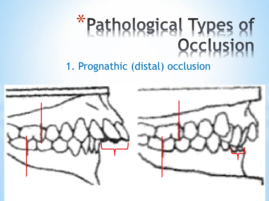 pathological types of