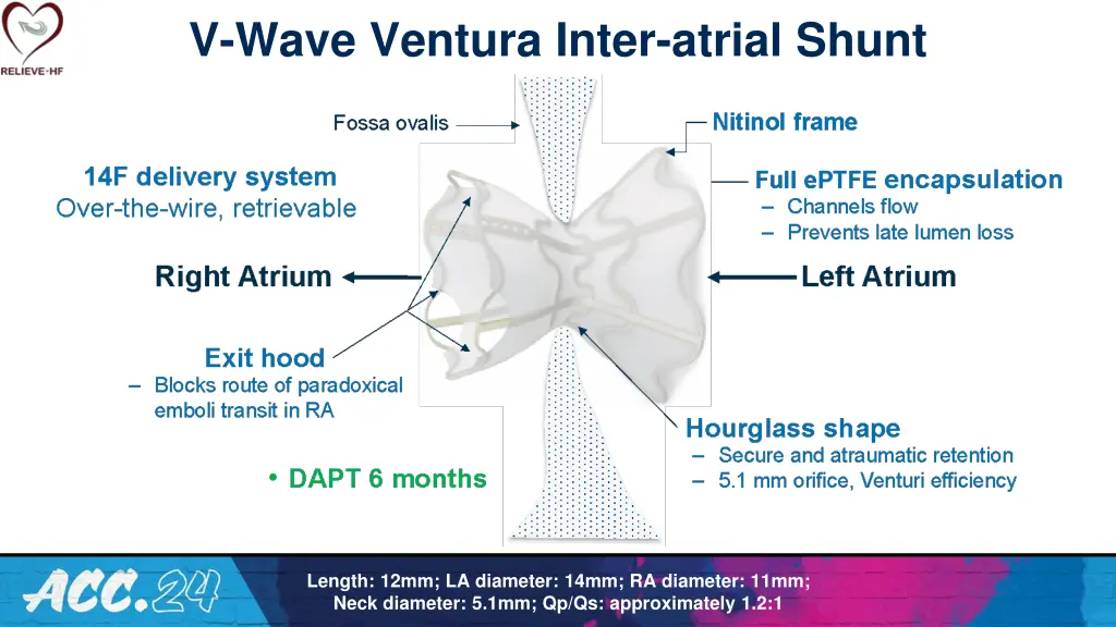 v wave ventura inter atrial shunt