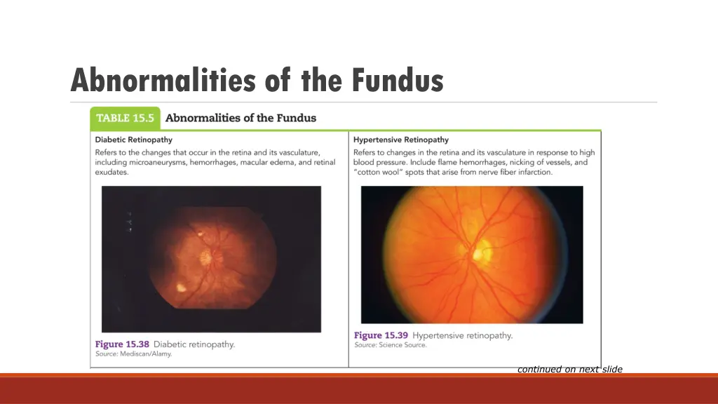 abnormalities of the fundus