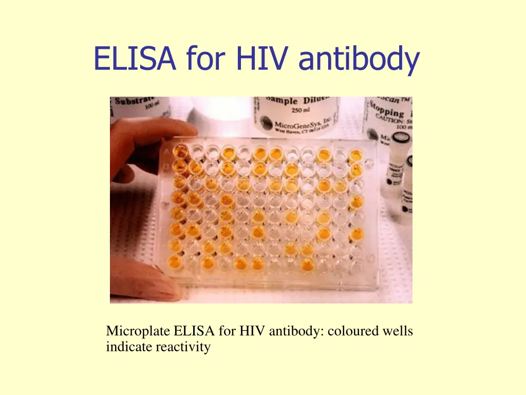 elisa for hiv antibody