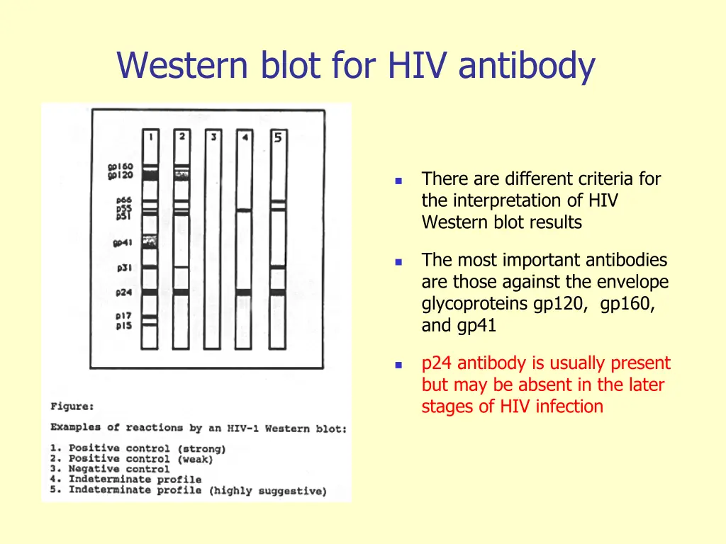 western blot for hiv antibody