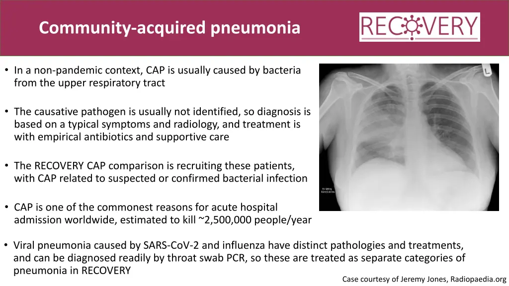 community acquired pneumonia