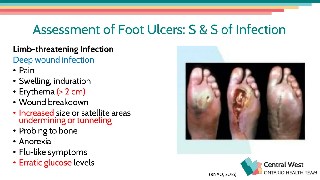 assessment of foot ulcers s s of infection 1