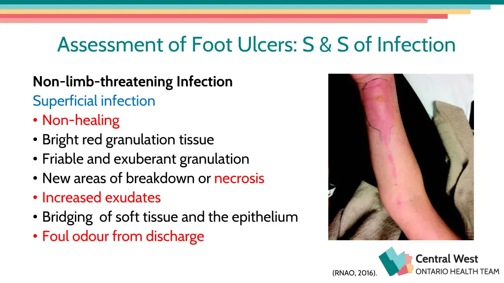 assessment of foot ulcers s s of infection