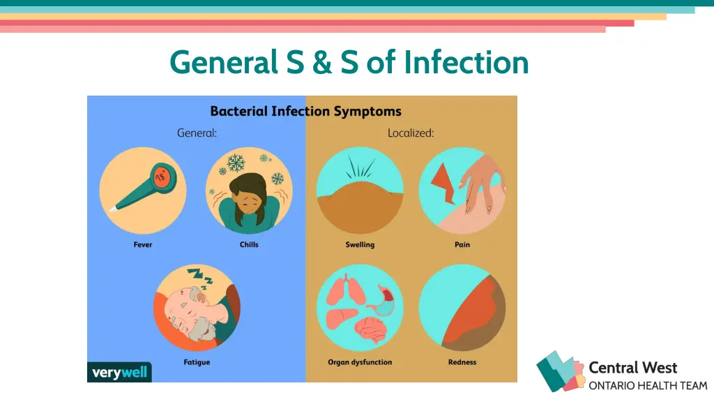 general s s of infection